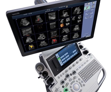 Kardiologija - Ultrazvučni pregled - Poliklinika Fizikus